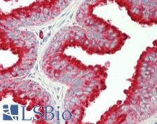 CD63 Antibody - Human Prostate: Formalin-Fixed, Paraffin-Embedded (FFPE)