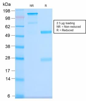 CD63 Antibody - SDS-PAGE Analysis Purified CD63 Rabbit Recombinant Monoclonal Antibody (LAMP3/2990R). Confirmation of Purity and Integrity of Antibody.