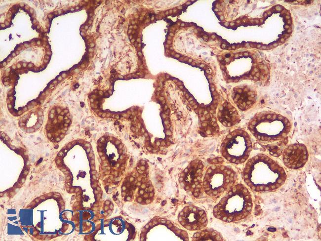 CD63 Antibody - Human Prostate: Formalin-Fixed, Paraffin-Embedded (FFPE)