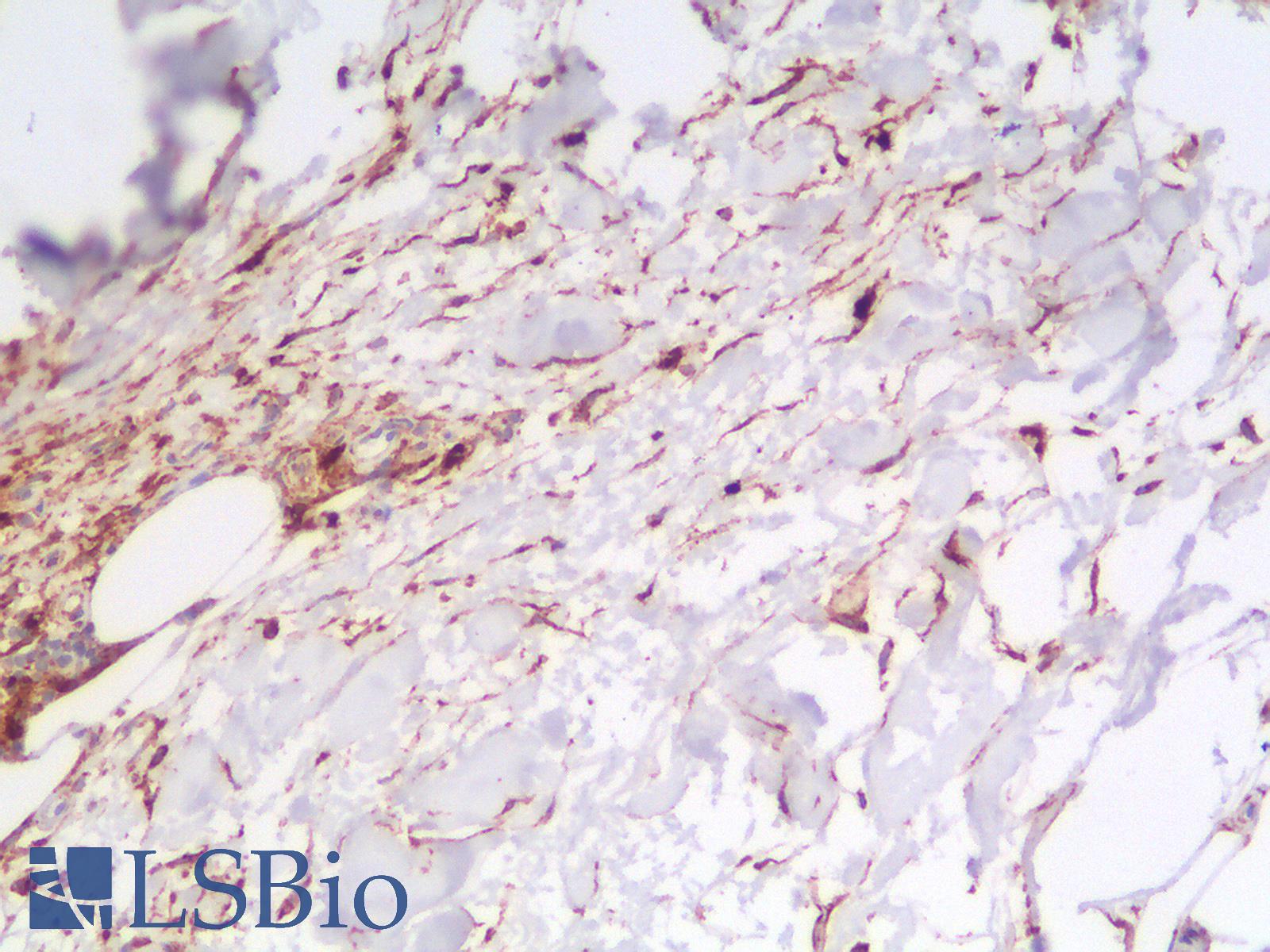 CD63 Antibody - Human Skin: Formalin-Fixed, Paraffin-Embedded (FFPE)