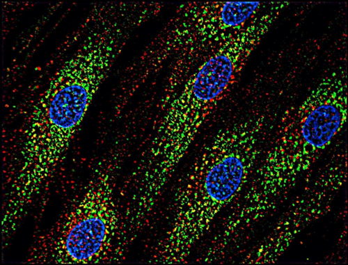 CD63 Antibody - Immunofluorescence staining of human skin fibroblasts with anti-CD63 (MEM-259; green) after co-incubation of living cells with human Transferrin - Dyomics 547; cell nuclei stained with DAPI (blue).