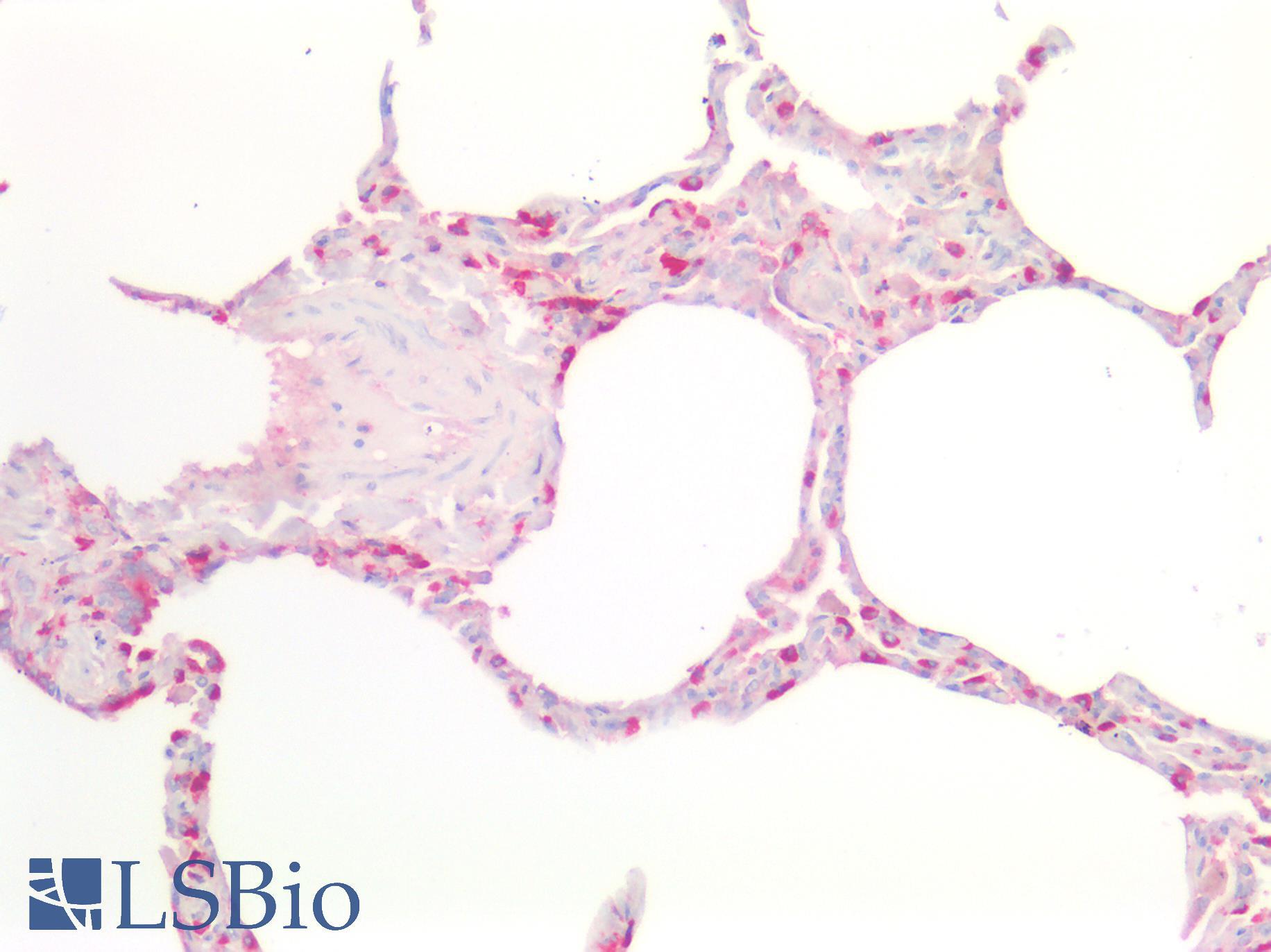 CD63 Antibody - Human Lung: Formalin-Fixed, Paraffin-Embedded (FFPE)