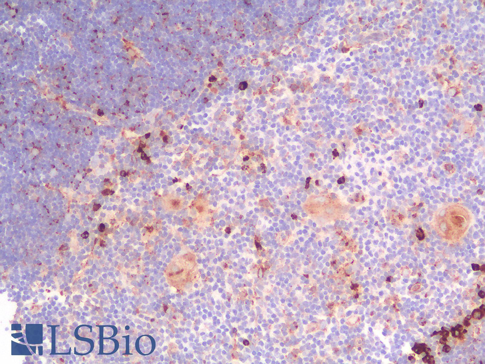 CD63 Antibody - Human Thymus: Formalin-Fixed, Paraffin-Embedded (FFPE)