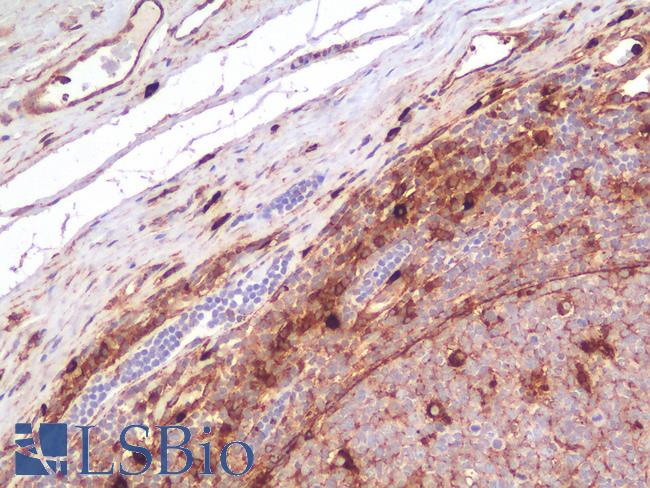 CD63 Antibody - Human Tonsil: Formalin-Fixed, Paraffin-Embedded (FFPE)