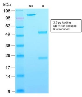 CD63 Antibody - SDS-PAGE Analysis Purified CD63 Mouse Recombinant Monoclonal Antibody (rMX-49.129.5). Confirmation of Purity and Integrity of Antibody.