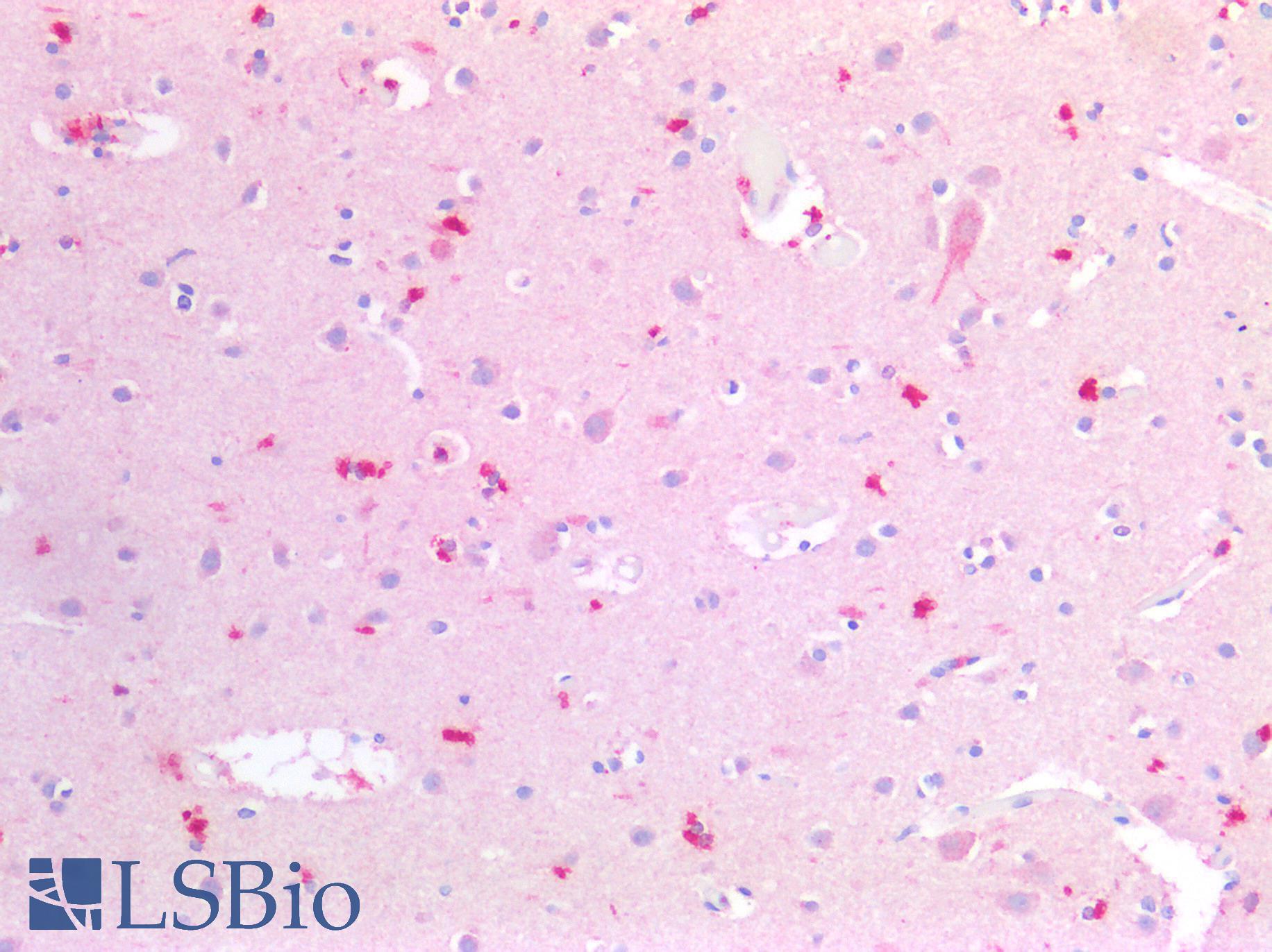 CD63 Antibody - Human Brain, Cortex: Formalin-Fixed, Paraffin-Embedded (FFPE)