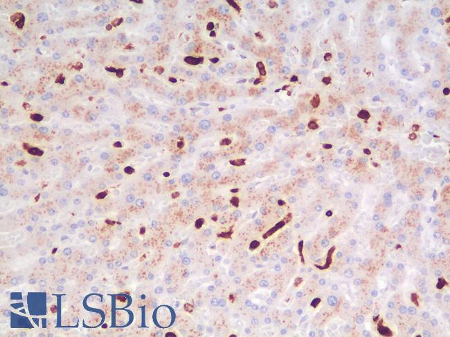 CD68 Antibody - Human Liver: Formalin-Fixed, Paraffin-Embedded (FFPE)