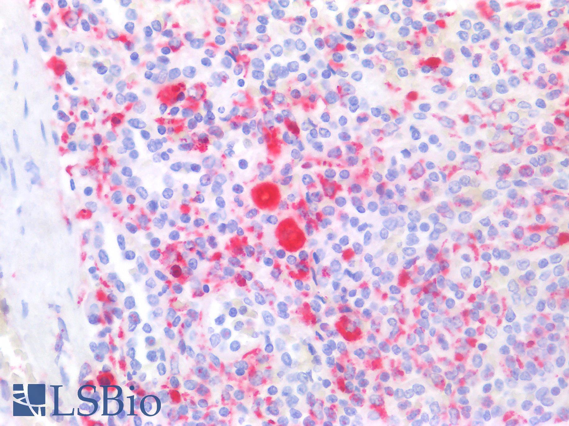 CD68 Antibody - Human Spleen: Formalin-Fixed, Paraffin-Embedded (FFPE)