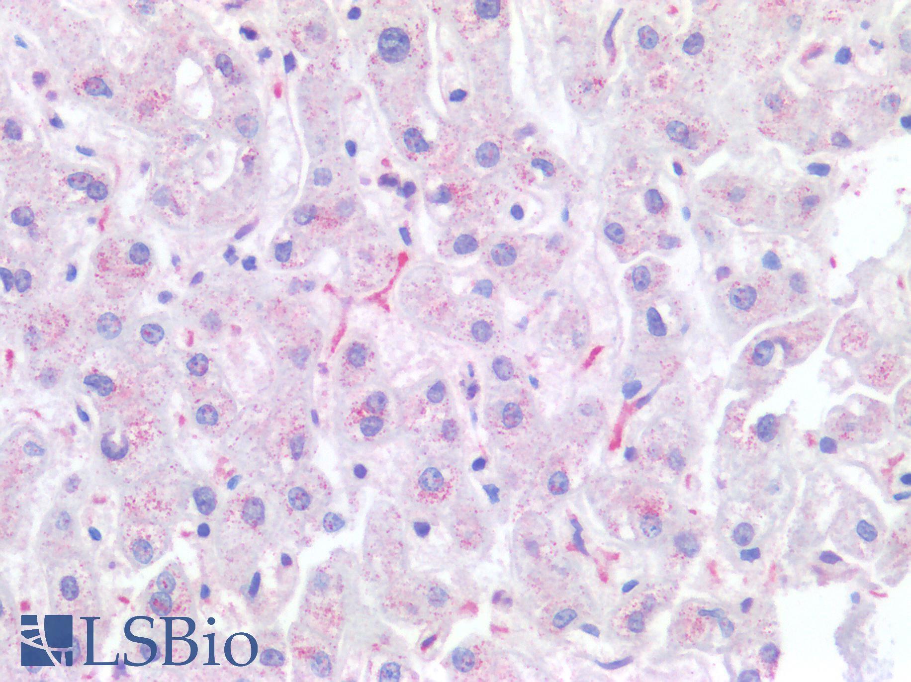 CD68 Antibody - Human Liver, Kupffer Cells: Formalin-Fixed, Paraffin-Embedded (FFPE)