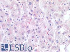 CD68 Antibody - Human Liver, Kupffer Cells: Formalin-Fixed, Paraffin-Embedded (FFPE)