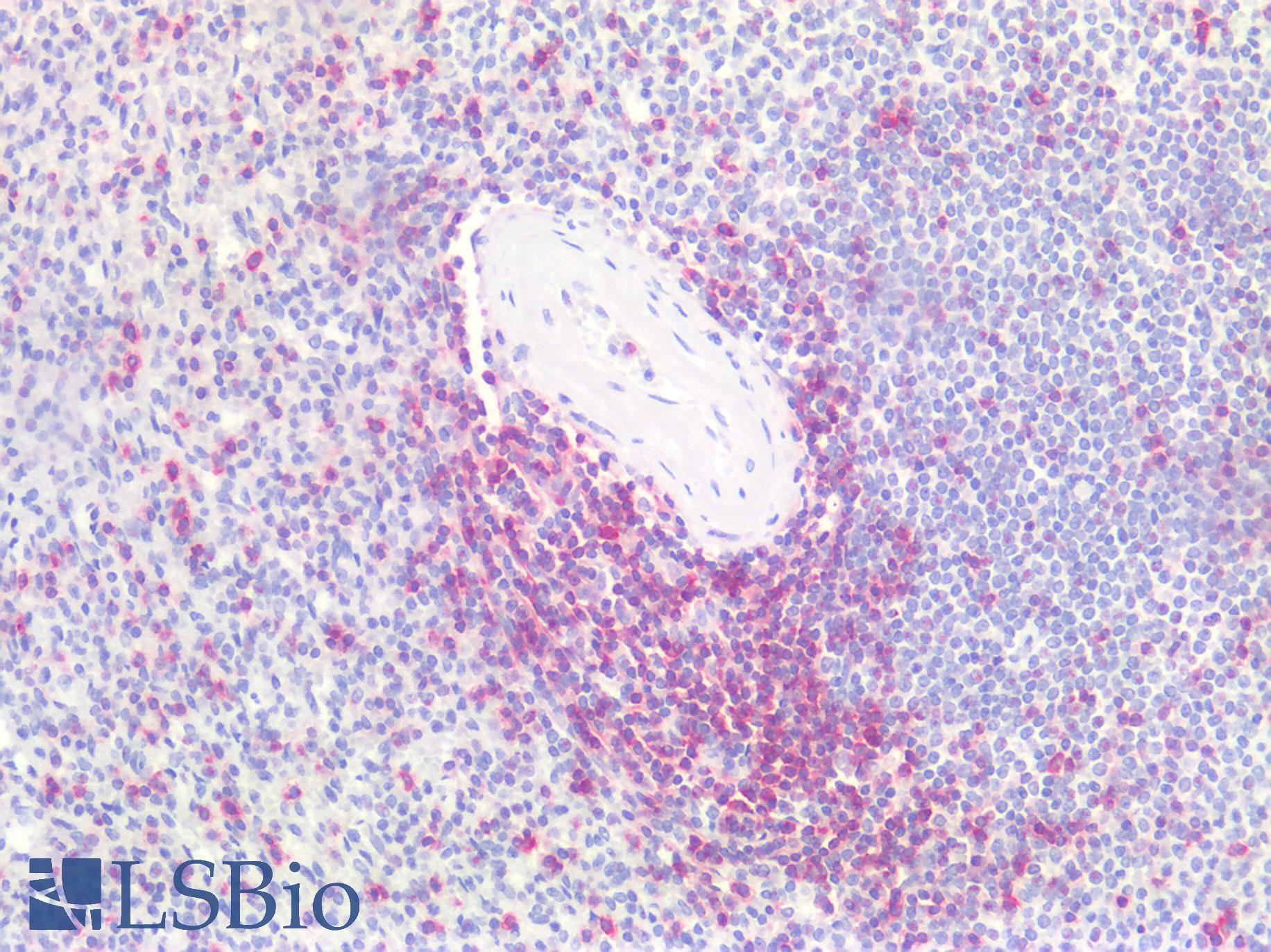 CD7 Antibody - Human Spleen: Formalin-Fixed, Paraffin-Embedded (FFPE)