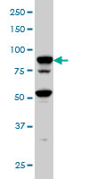 CD71 / Transferrin Receptor Antibody - TFRC monoclonal antibody (M01), clone 1E6 Western blot of TFRC expression in HeLa NE.