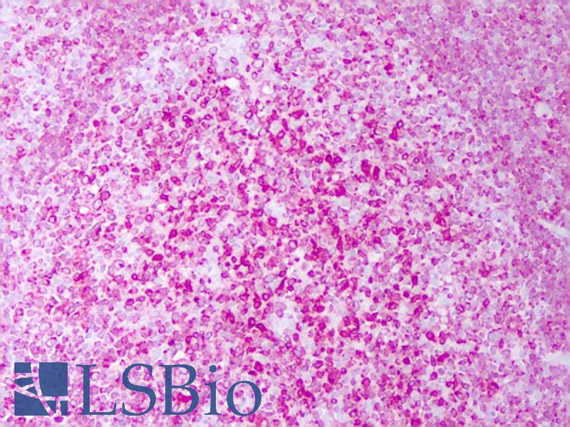 CD74 / CLIP Antibody - Anti-CD74 antibody IHC of human tonsil, lymphocytes. Immunohistochemistry of formalin-fixed, paraffin-embedded tissue after heat-induced antigen retrieval. Antibody concentration 10 ug/ml.  This image was taken for the unconjugated form of this product. Other forms have not been tested.