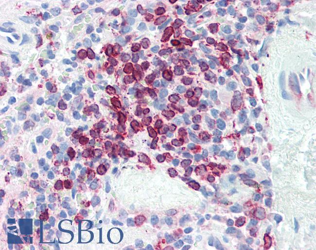 CD74 / CLIP Antibody - Human Spleen: Formalin-Fixed, Paraffin-Embedded (FFPE)