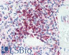 CD74 / CLIP Antibody - Human Spleen: Formalin-Fixed, Paraffin-Embedded (FFPE)