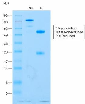 CD79A / CD79 Alpha Antibody - SDS-PAGE Analysis of Purified CD79a Rabbit Recombinant Monoclonal Antibody (IGA/1688R). Confirmation of Purity and Integrity of Antibody.