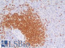 CD79A / CD79 Alpha Antibody - Human Spleen: Formalin-Fixed, Paraffin-Embedded (FFPE)