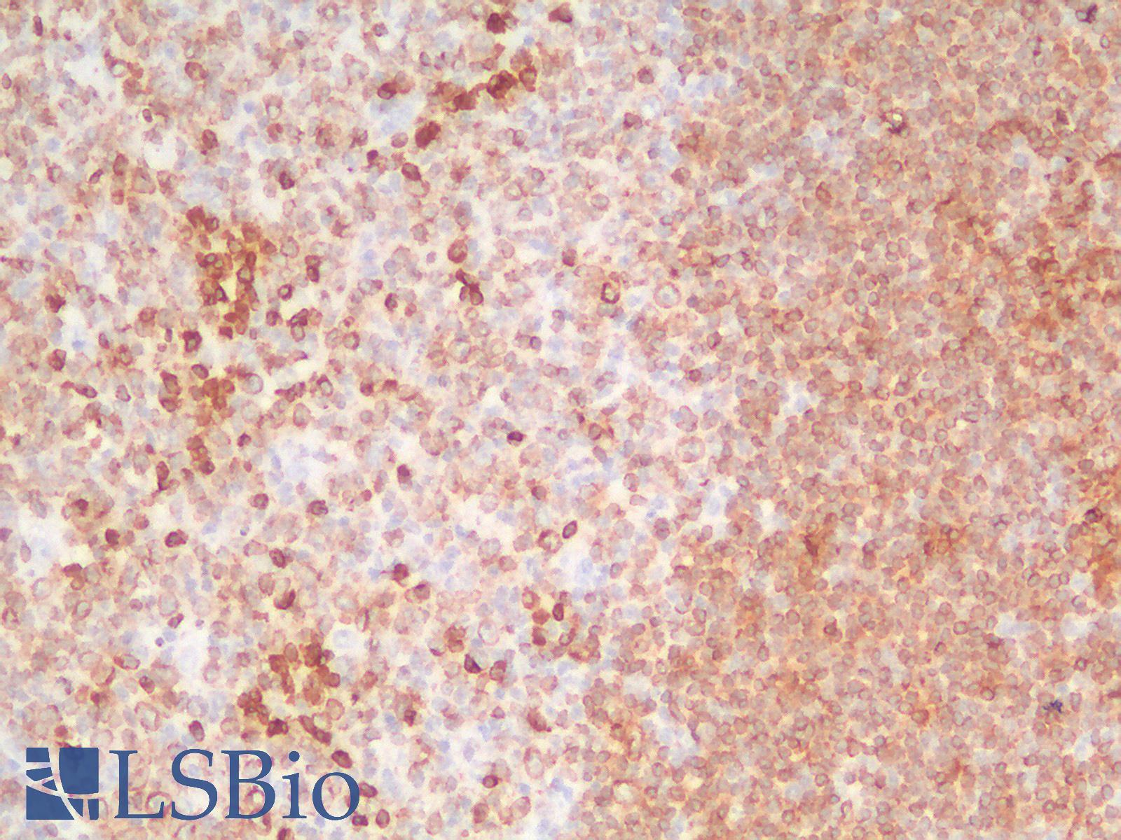 CD79A / CD79 Alpha Antibody - Human Tonsil: Formalin-Fixed, Paraffin-Embedded (FFPE)