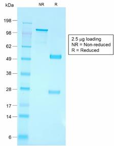 CD79A / CD79 Alpha Antibody - SDS-PAGE Analysis Purified CD79a Rabbit Recombinant Monoclonal Antibody (IGA/1790R). Confirmation of Purity and Integrity of Antibody.