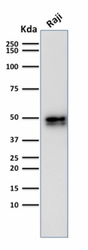 CD79A / CD79 Alpha Antibody - Western Blot Analysis of Raji Cell Lysate using CD79a Rabbit Recombinant Monoclonal Antibody (IGA/1790).