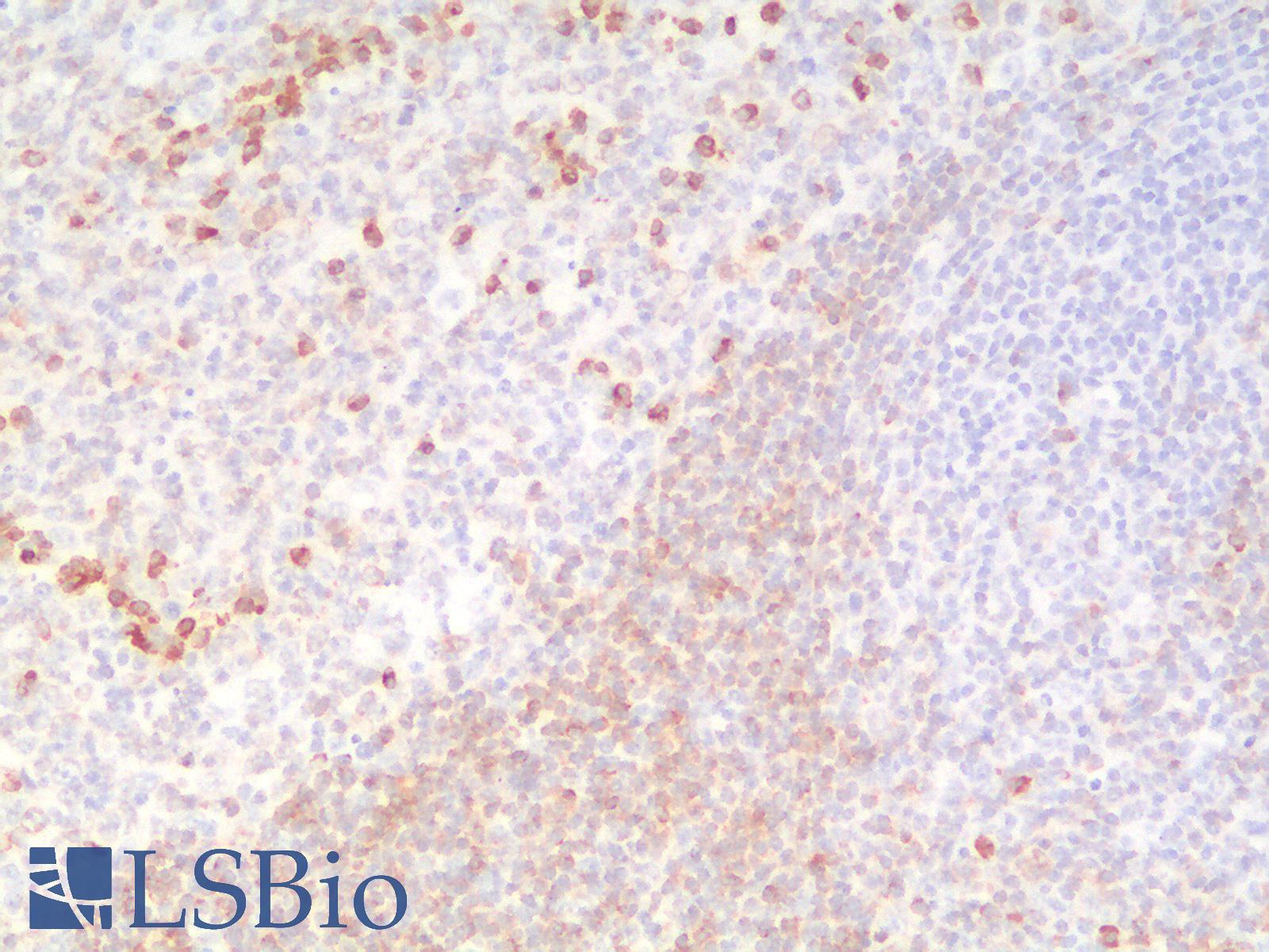 CD79A / CD79 Alpha Antibody - Human Tonsil: Formalin-Fixed, Paraffin-Embedded (FFPE)