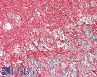 CD81 Antibody - Human Brain, Cerebellum: Formalin-Fixed, Paraffin-Embedded (FFPE)