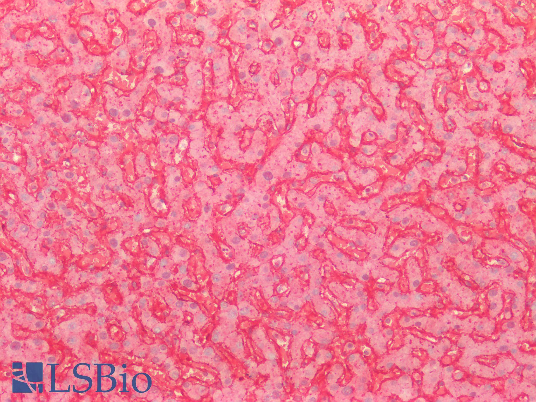 CD81 Antibody - Human Liver: Formalin-Fixed, Paraffin-Embedded (FFPE)