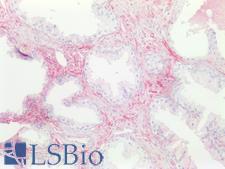 CD81 Antibody - Human Prostate: Formalin-Fixed, Paraffin-Embedded (FFPE)