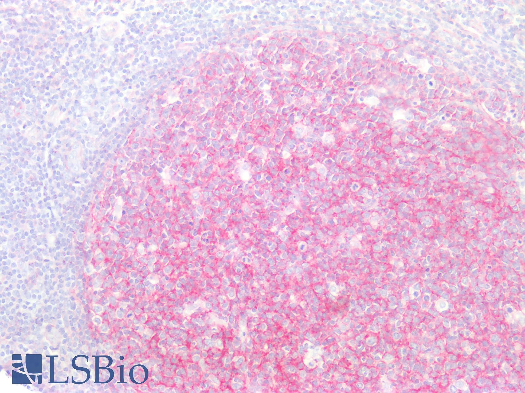 CD81 Antibody - Human Tonsil: Formalin-Fixed, Paraffin-Embedded (FFPE)
