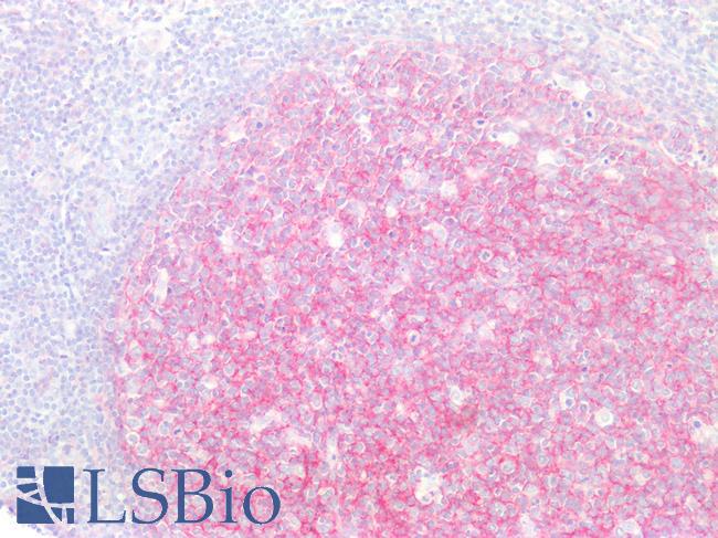 CD81 Antibody - Human Tonsil: Formalin-Fixed, Paraffin-Embedded (FFPE)