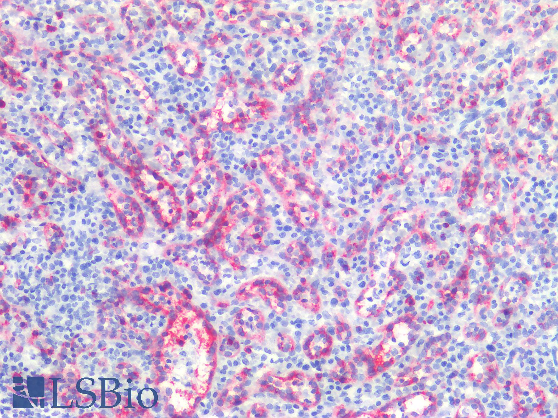 CD8A / CD8 Alpha Antibody - Human Spleen: Formalin-Fixed, Paraffin-Embedded (FFPE)
