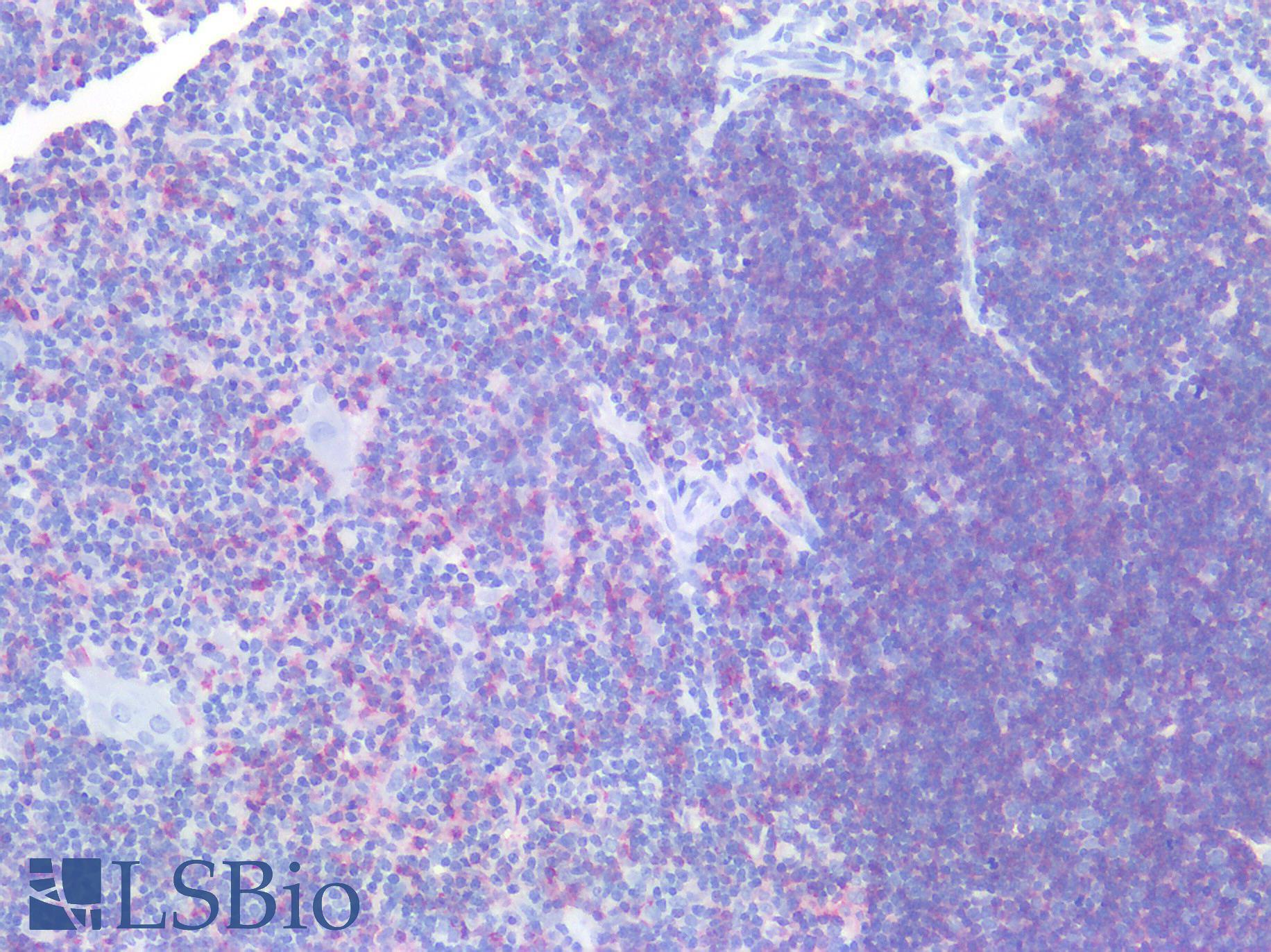 CD8A / CD8 Alpha Antibody - Human Thymus: Formalin-Fixed, Paraffin-Embedded (FFPE)