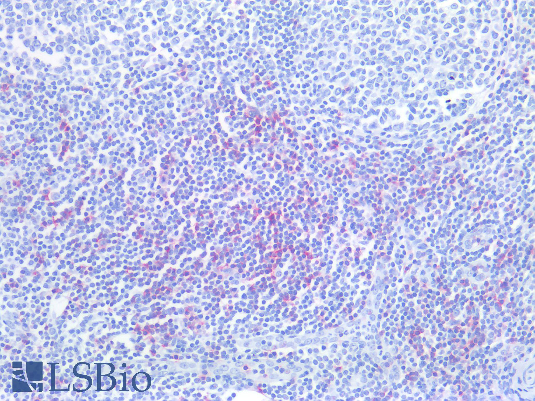CD8A / CD8 Alpha Antibody - Human Tonsil: Formalin-Fixed, Paraffin-Embedded (FFPE)