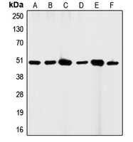 CD95 / FAS Antibody - Western blot analysis of CD95 expression in HeLa (A); A431 (B); K562 (C); HL60 (D); mouse brain (E); H9C2 (F) whole cell lysates.