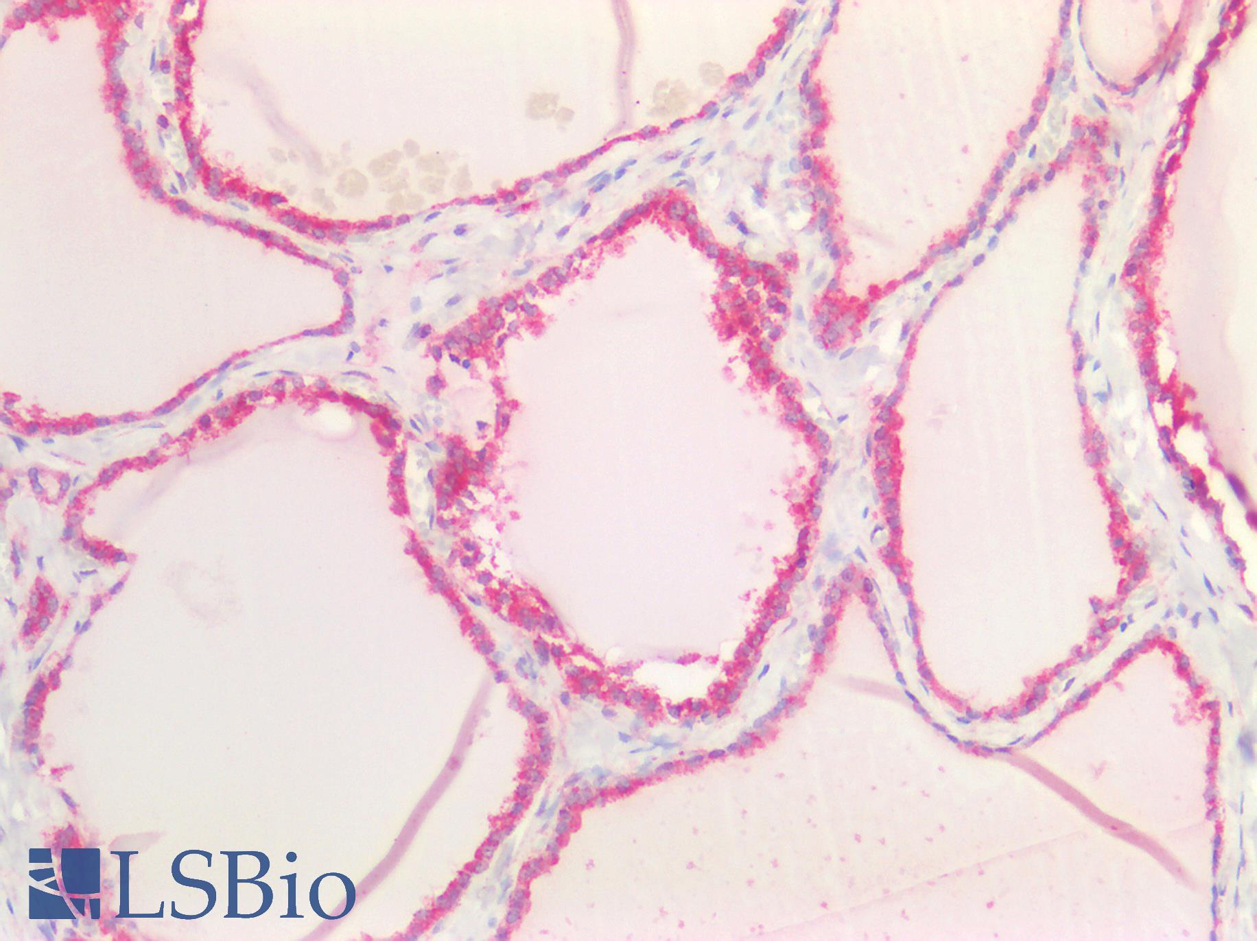CD95 / FAS Antibody - Human Thyroid: Formalin-Fixed, Paraffin-Embedded (FFPE)