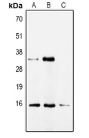 CDA / Cytidine Deaminase Antibody - Western blot analysis of CDA expression in HepG2 (A); HeLa (B); mouse kidney (C) whole cell lysates.