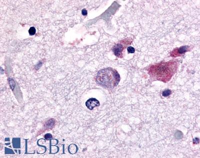 CDC7 Antibody - Brain, Alzheimer's neurofibrillary tangle and granulovacuolar degeneration