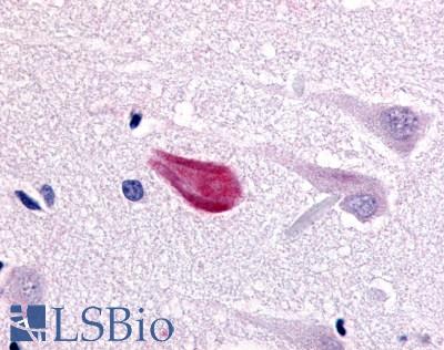 CDC7 Antibody - Brain, Alzheimer's neurofibrillary tangle