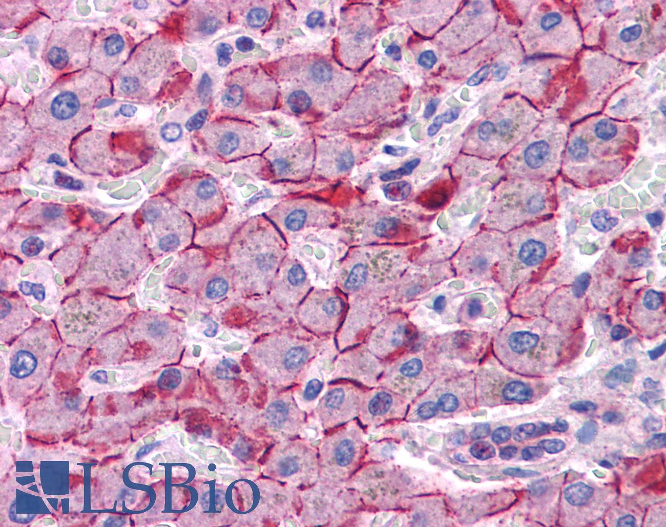 CDH1 / E Cadherin Antibody - Anti-E Cadherin antibody IHC of human liver. Immunohistochemistry of formalin-fixed, paraffin-embedded tissue after heat-induced antigen retrieval. Antibody concentration 5 ug/ml.  This image was taken for the unconjugated form of this product. Other forms have not been tested.