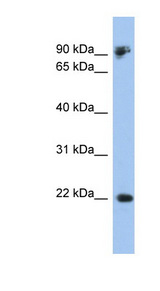CDH1 / E Cadherin Antibody - CDH1 / E Cadherin antibody Western blot of 293T cell lysate. This image was taken for the unconjugated form of this product. Other forms have not been tested.