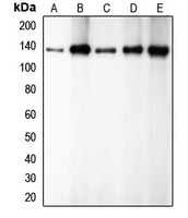 CDH1 / E Cadherin Antibody - Western blot analysis of E Cadherin expression in HEK293T (A); PC12 (B); A431 (C); MCF7 (D); C2C12 (E) whole cell lysates.