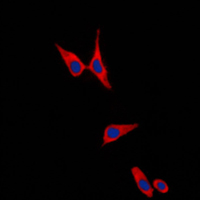 CDH1 / E Cadherin Antibody - Immunofluorescent analysis of E Cadherin staining in PC12 cells. Formalin-fixed cells were permeabilized with 0.1% Triton X-100 in TBS for 5-10 minutes and blocked with 3% BSA-PBS for 30 minutes at room temperature. Cells were probed with the primary antibody in 3% BSA-PBS and incubated overnight at 4 C in a humidified chamber. Cells were washed with PBST and incubated with a DyLight 594-conjugated secondary antibody (red) in PBS at room temperature in the dark. DAPI was used to stain the cell nuclei (blue).