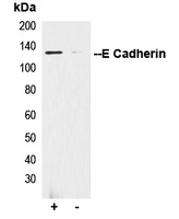 CDH1 / E Cadherin Antibody - Immunoprecipitation of E Cadherin from 0.5mg HEK293F whole cell extract lysate using 5ug of Anti-E Cadherin Antibody and 50ul of protein G magnetic beads (+). No antibody was added to the control (-). The antibody was incubated under agitation with Protein G beads for 10min HEK293F whole cell extract lysate diluted in RIPA buffer was added to each sample and incubated for a further 10min under agitation. Proteins were eluted by addition of 40ul SDS loading buffer and incubated for 10min at 70 C; 10ul of each sample was separated on a SDS PAGE gel transferred to a nitrocellulose membrane blocked with 5% BSA and probed with Anti-E Cadherin Antibody.