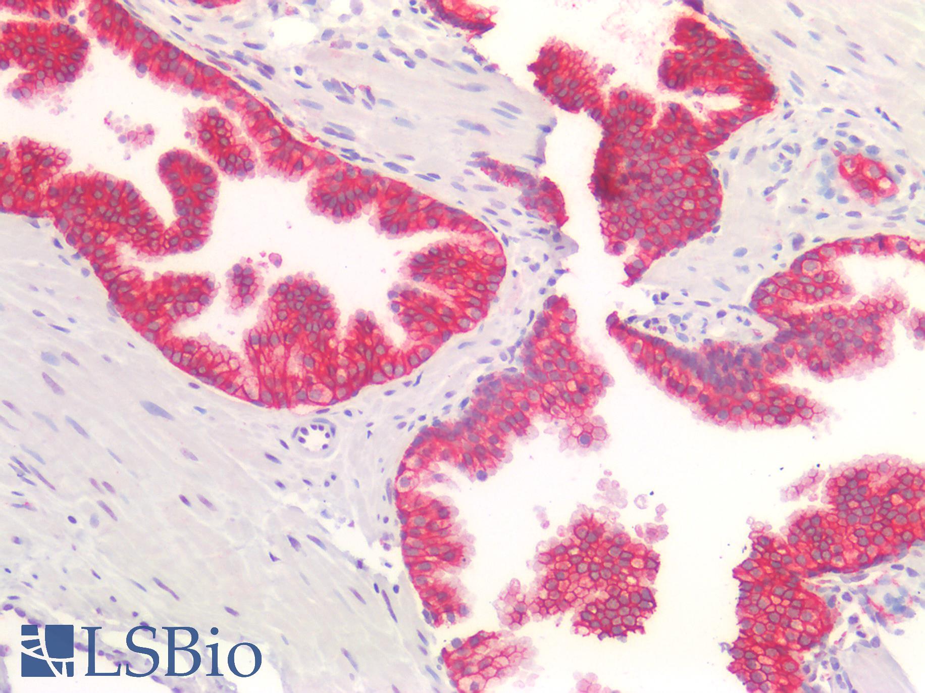 CDH1 / E Cadherin Antibody - Human Prostate: Formalin-Fixed, Paraffin-Embedded (FFPE)