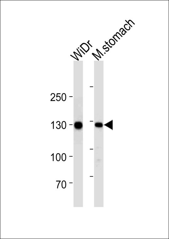 CDH1 / E Cadherin Antibody - CDH1 Antibody western blot of WiDr cell line and mouse stomach tissue lysates (35 ug/lane). The CDH1 antibody detected the CDH1 protein (arrow).