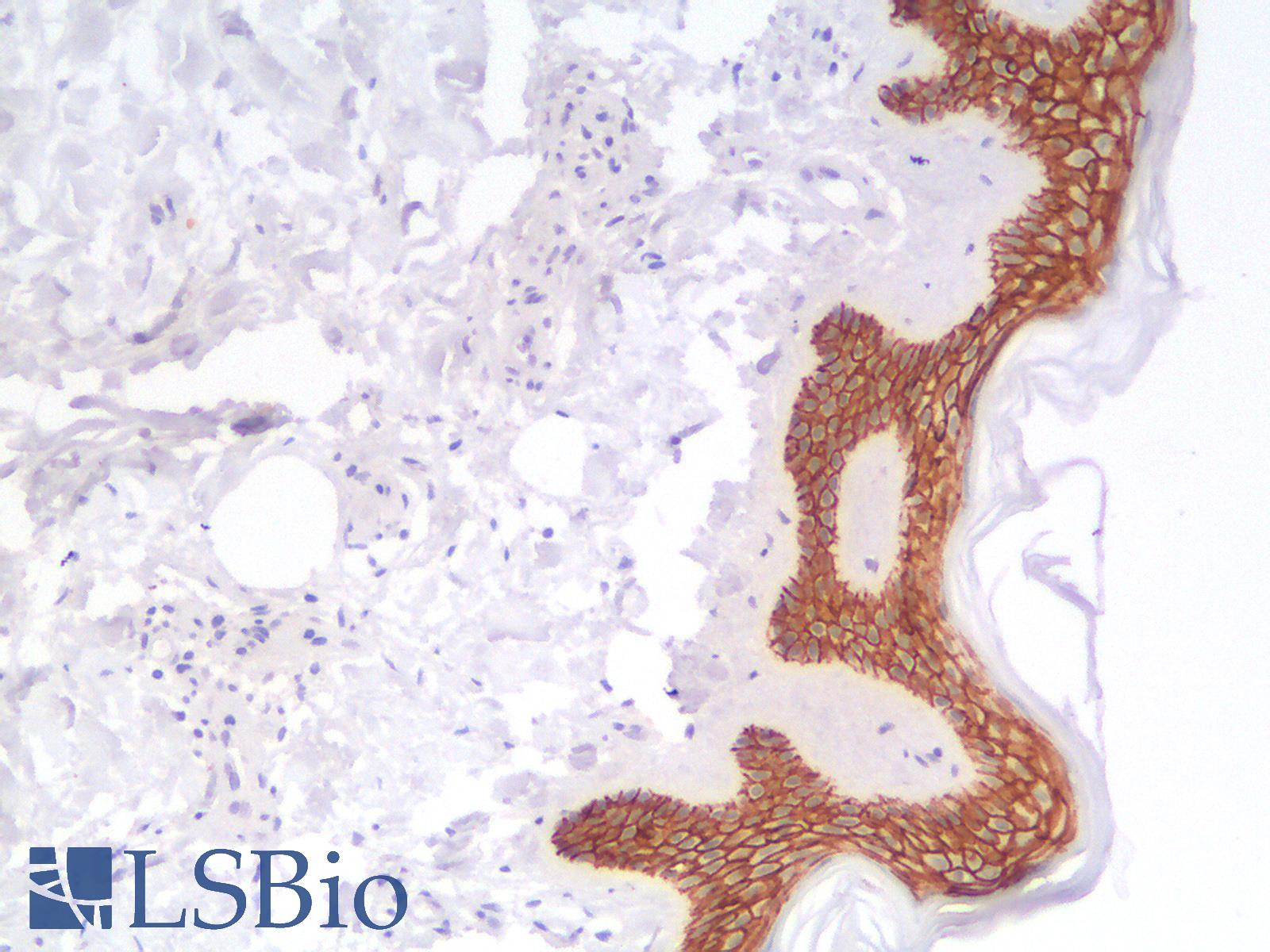 CDH1 / E Cadherin Antibody - Human Skin: Formalin-Fixed, Paraffin-Embedded (FFPE)