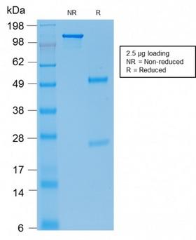 CDH1 / E Cadherin Antibody - SDS-PAGE Analysis Purified E-Cadherin Mouse Recombinant Monoclonal Ab (rCDH1/1525). Confirmation of Purity and Integrity of Antibody.