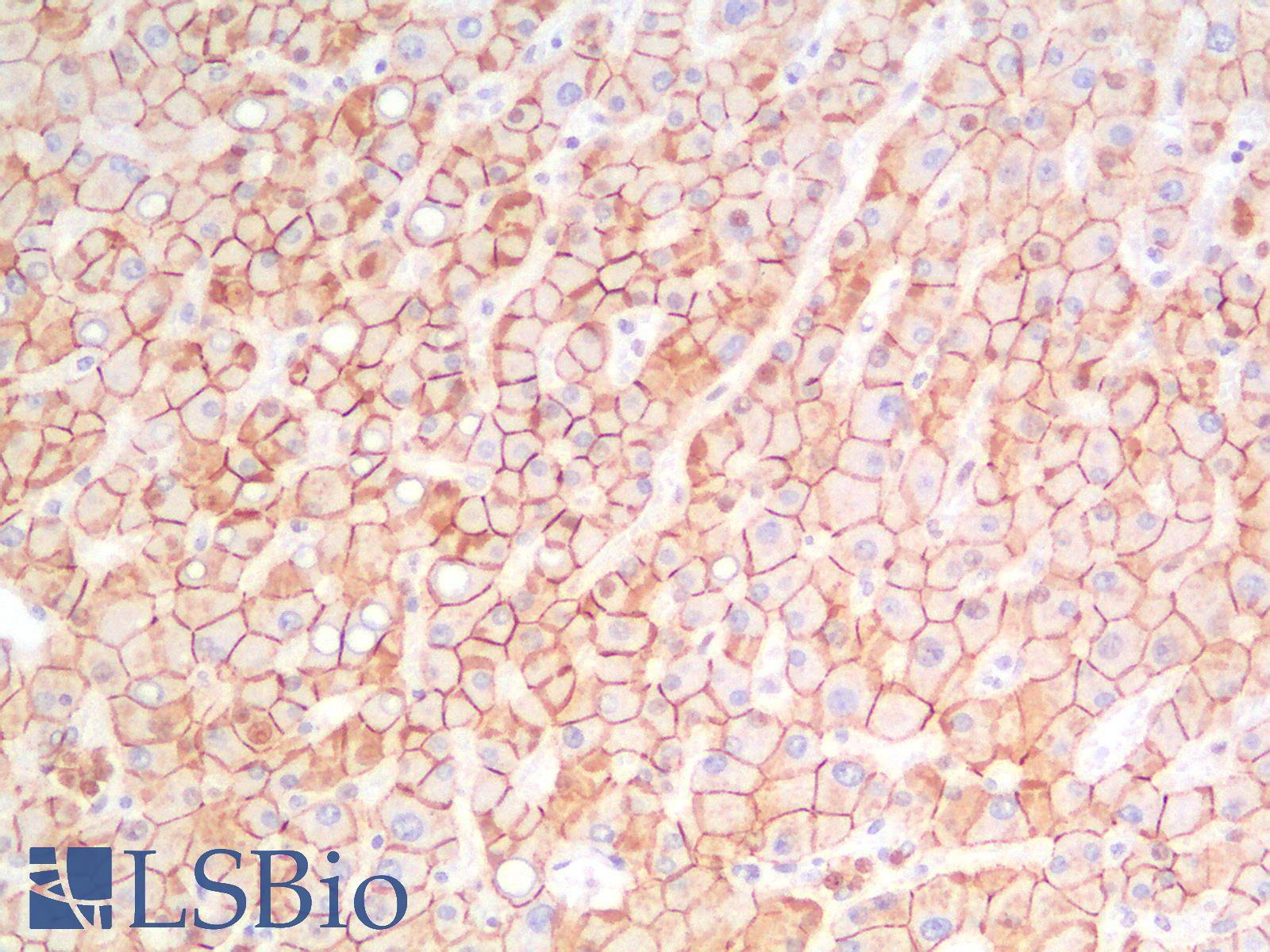 CDH1 / E Cadherin Antibody - Human Liver: Formalin-Fixed, Paraffin-Embedded (FFPE)