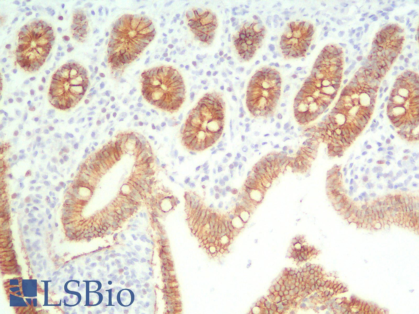 CDH1 / E Cadherin Antibody - Human Small Intestine: Formalin-Fixed, Paraffin-Embedded (FFPE)