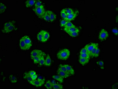 CDH1 / E Cadherin Antibody - Immunofluorescence staining of HepG2 cells with CDH1 Antibody at 1:100, counter-stained with DAPI. The cells were fixed in 4% formaldehyde, permeabilized using 0.2% Triton X-100 and blocked in 10% normal Goat Serum. The cells were then incubated with the antibody overnight at 4°C. The secondary antibody was Alexa Fluor 488-congugated AffiniPure Goat Anti-Rabbit IgG(H+L).